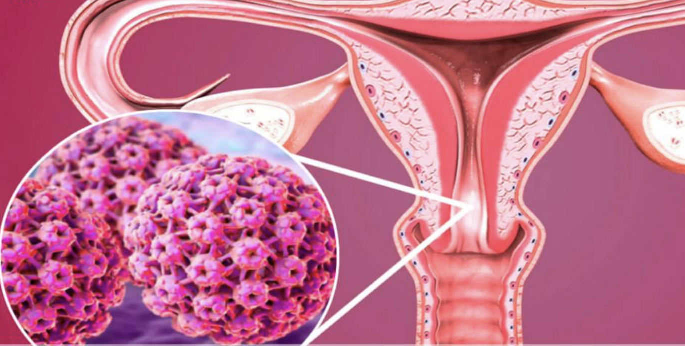 Dra. Marcella Conz Coloproctologia, Laser em coloproctologia
▫️Doenças Inflamatórias Intestinais São Bernardo do Campo